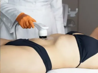 Aplicação do Hertix Smart em protocolo de contorno corporal