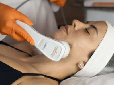 Aplicação do Hertix Smart em protocolo facial